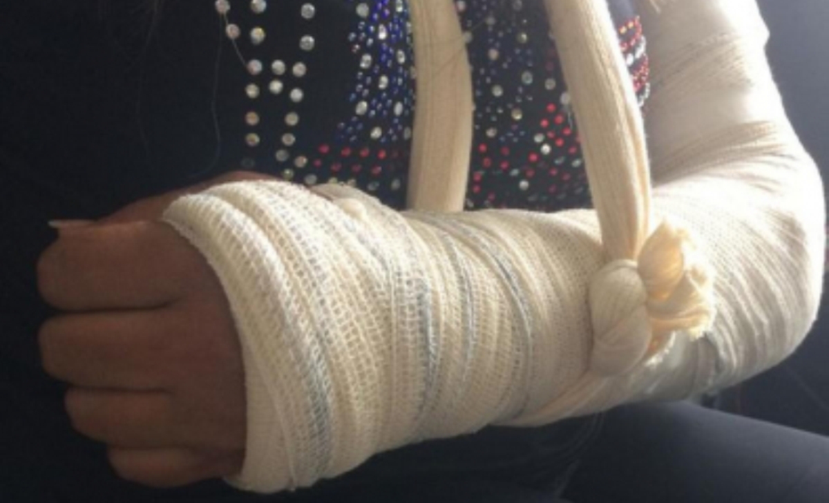 Mulher é espancada e tem braço quebrado por marido