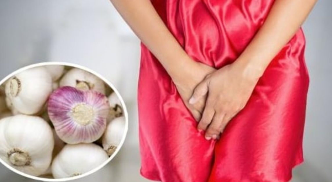 Médica alerta mulheres para não colocarem alho em suas vaginas