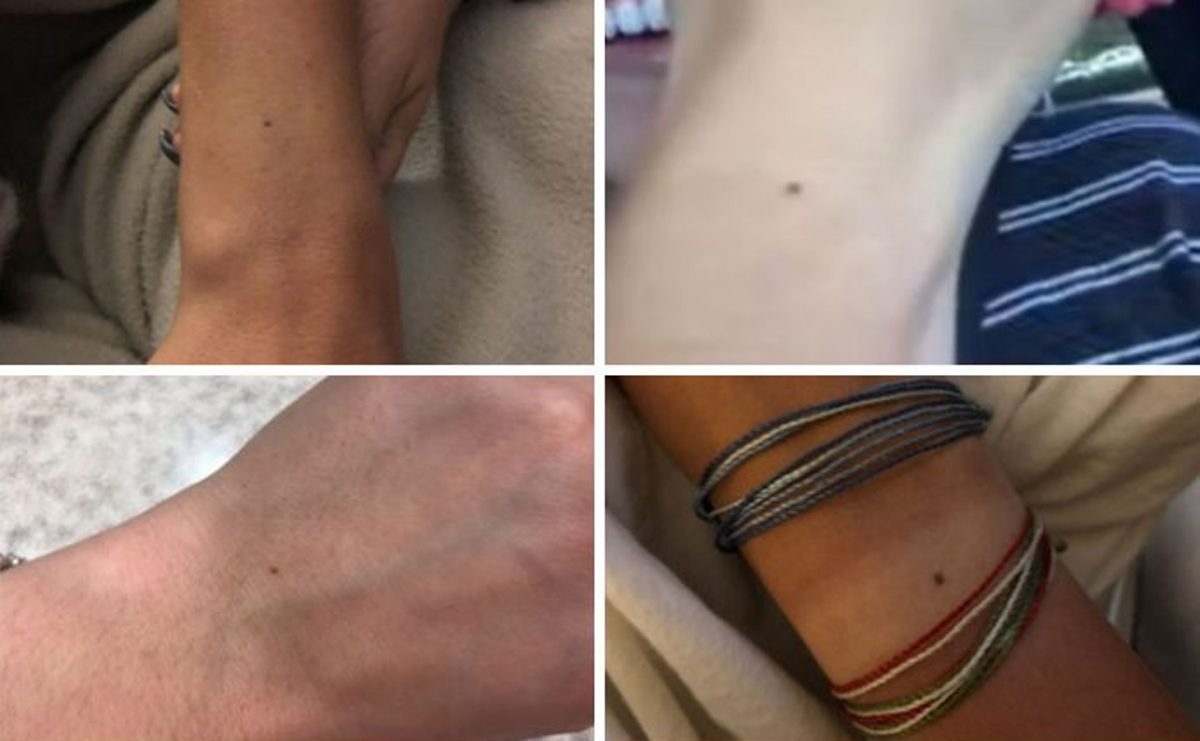 Todas as mulheres do mundo têm a mesma pinta? Internauta lança desafio e se surpreende com resultado