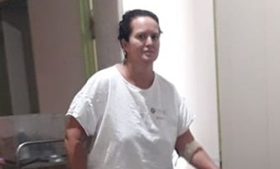 Internada com queimaduras causadas por bronzeamento com chá de folha de figo já consegue andar