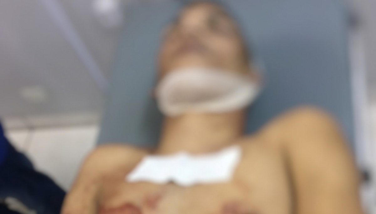 Ladrão rouba carro de caminhão cegonha; troca tiros com PM e morre em Várzea Grande