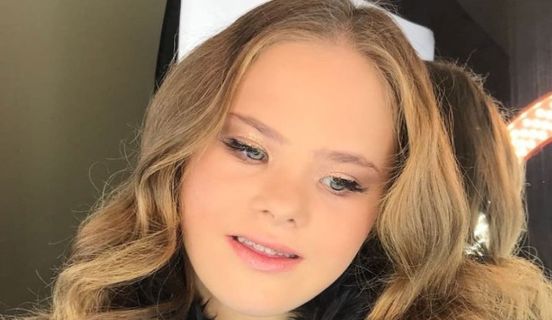 Modelo brasileira com síndrome de Down é capa de revista australiana