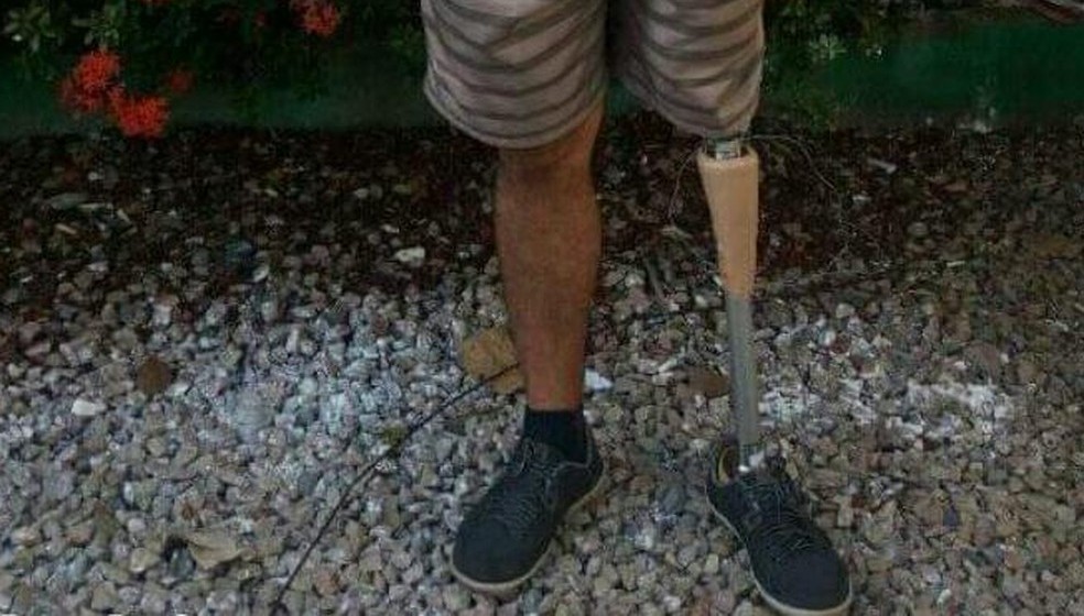 Procuradora vira ré por bater em caminhão de coleta de lixo que estava parado e esmagar perna de gari em Cuiabá