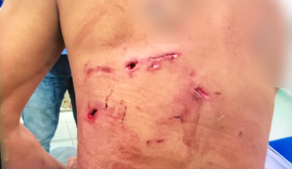 Homem atacado por onça-pintada é salvo por 5 cachorros em MS