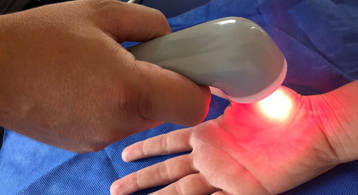 Criador de terapia para fibromialgia trabalha em novo aparelho portátil 