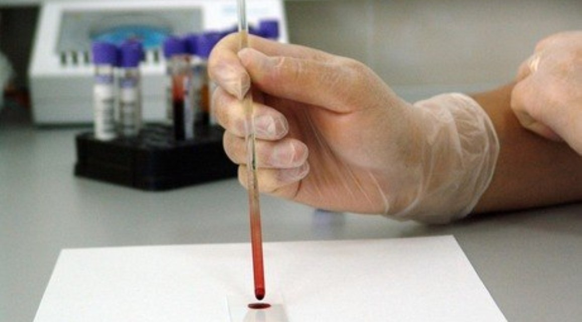 Chance de contrair zika pode ser menor para quem já teve dengue