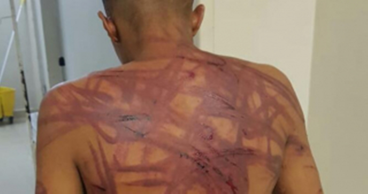 Encapuzados sequestram e torturam jovem em Várzea Grande