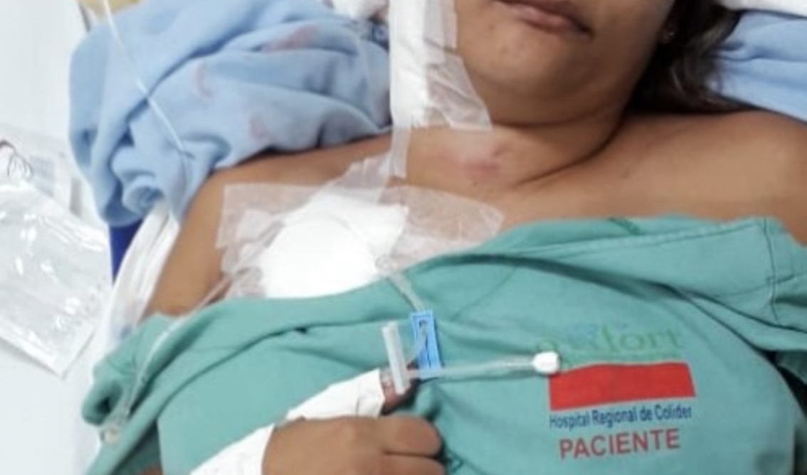 Homem esfaqueia ex-mulher que é salva por cachorros