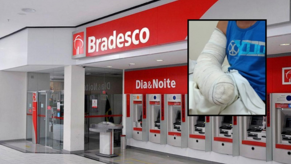 Bradesco impede cuiabano sem mão de sacar dinheiro por não conseguir assinar comprovante