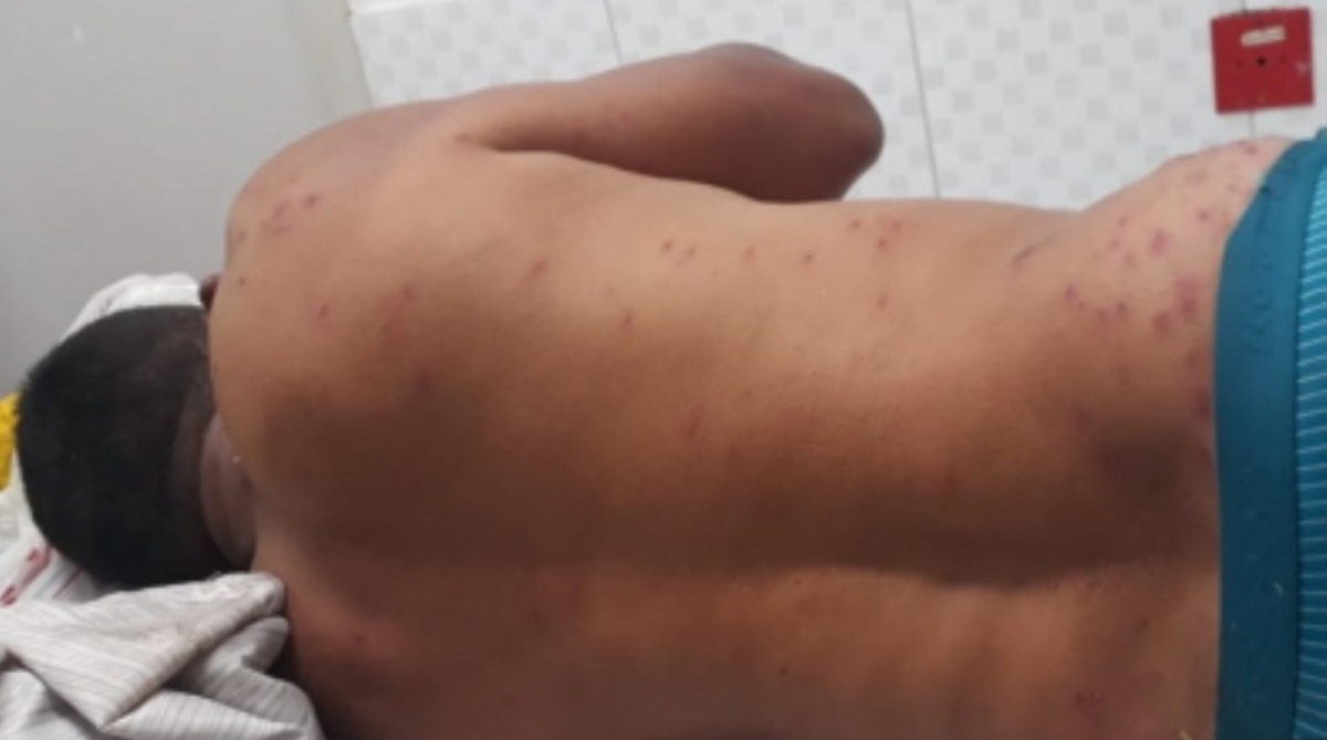 Rondonópolis | Trabalhador é internado após ser atacado por abelhas