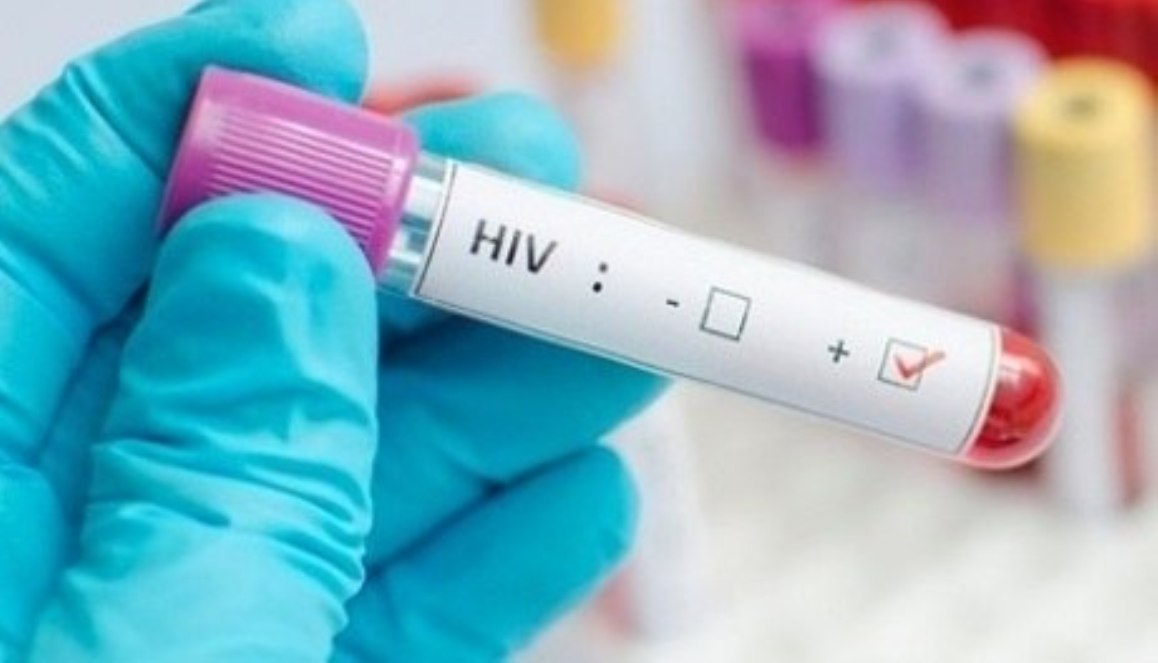 Cientistas descobrem formas de eliminar HIV totalmente das células