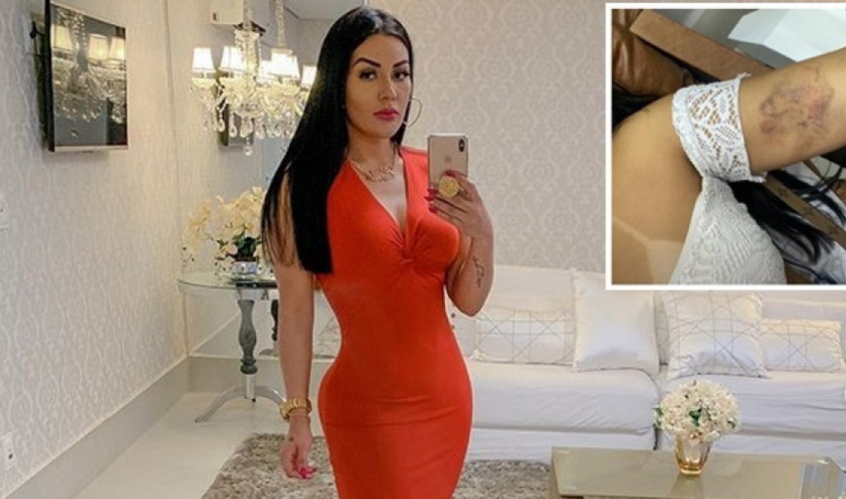 Em redes sociais, digital influencer mostra hematomas e acusa namorado em Cuiabá