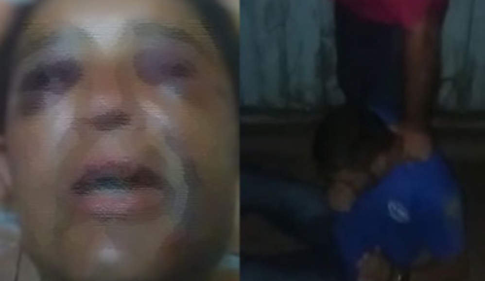 Várzea Grande | Filho espanca mãe por reclamar de bagunça em casa e é golpeado com pauladas e chicotadas