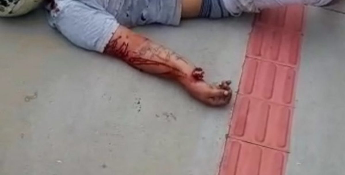 Rondonópolis | Motociclista fica gravemente ferido após BMW invadir preferencial