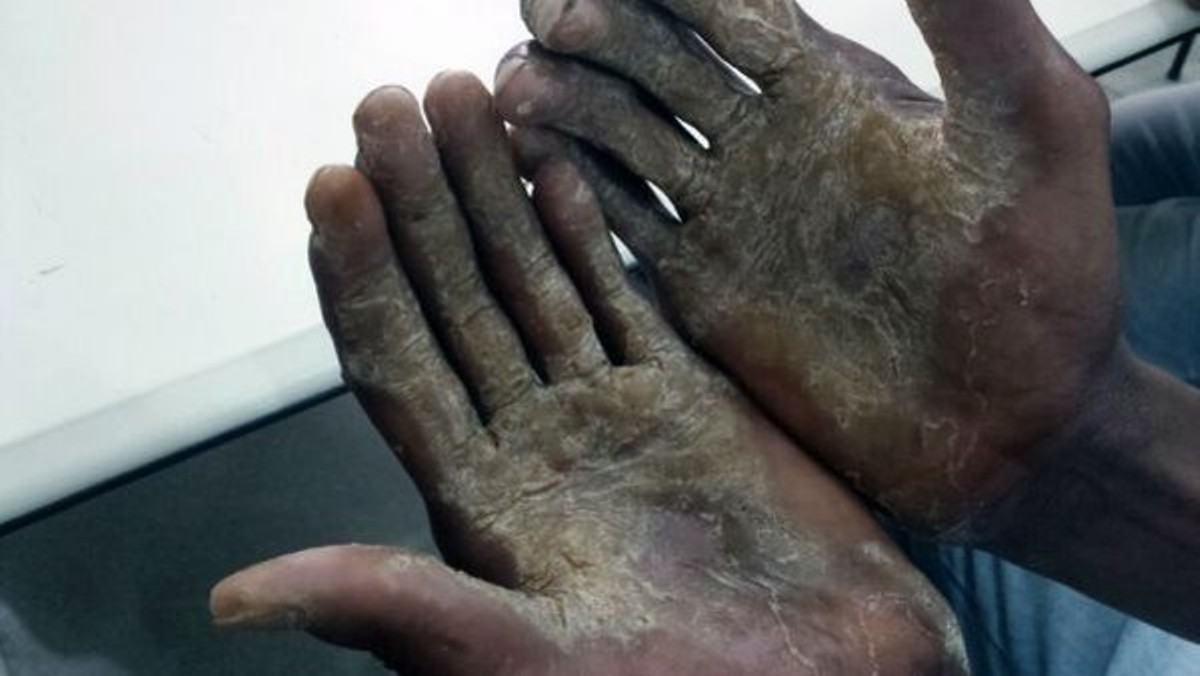 Quase 30 pessoas são resgatadas em situação de trabalho escravo em MT em 2019