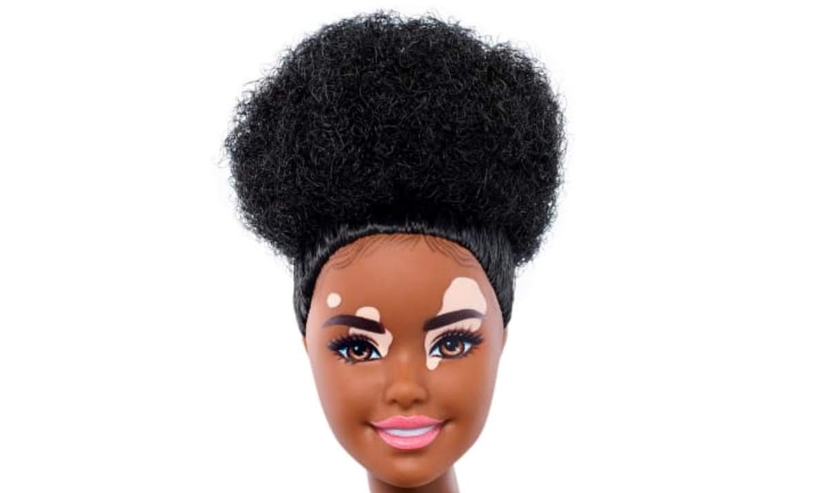 Barbie lança novas bonecas inclusivas com vitiligo e até careca