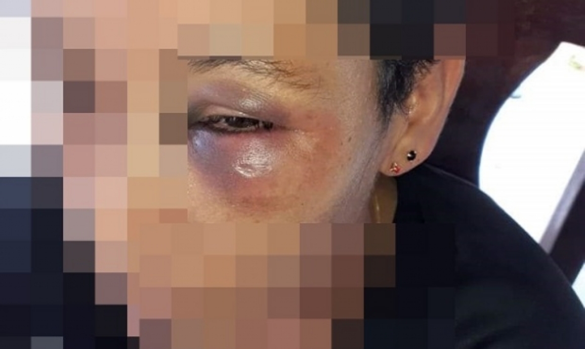 Juína | Mulher é espancada e ameaça de morte pela ex namorada e companheira