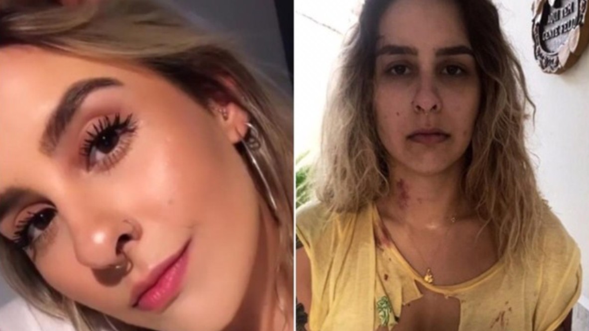 Ex-namorada denuncia DJ por violência em Cuiabá: ‘Fui vítima de agressão física e não foi só uma vez’