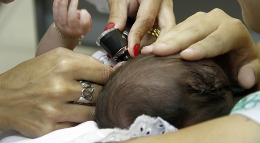 22 crianças com microcefalia em MT pedem pensão vitalícia ao INSS