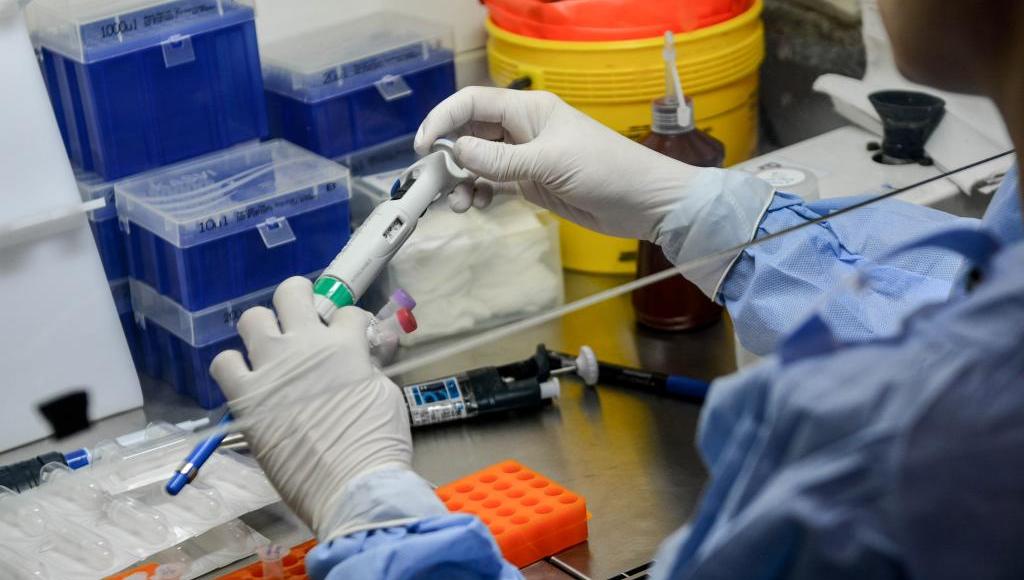 Sobe para 73 o número de casos suspeitos de Covid-19 em Mato Grosso