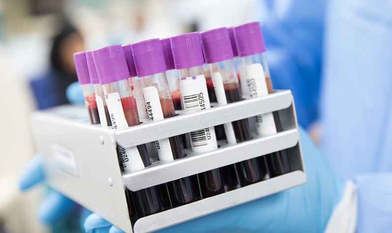 Albert Einstein e Sírio Libanês farão testes com sangue de curados do covid-19