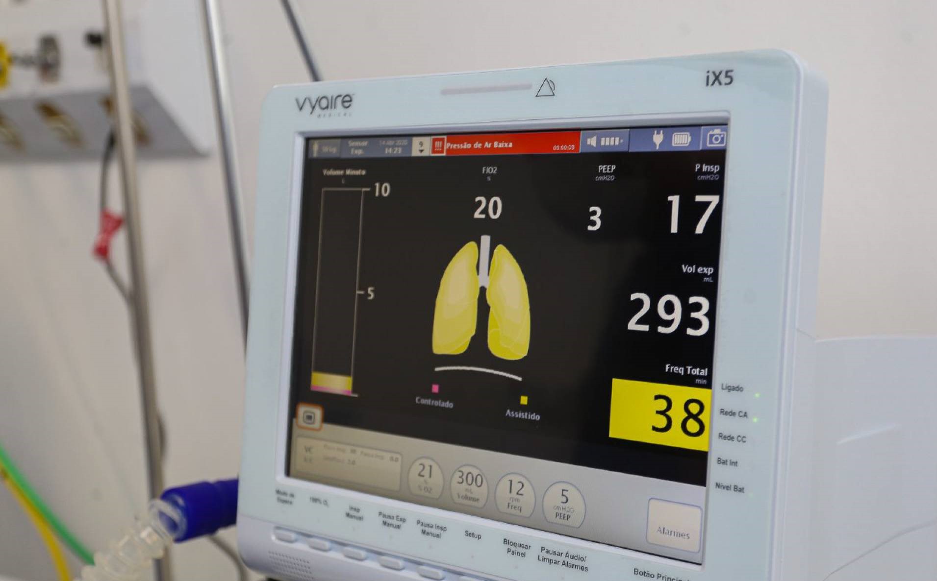 MPRJ investiga compra de respiradores pulmonares superfaturadas