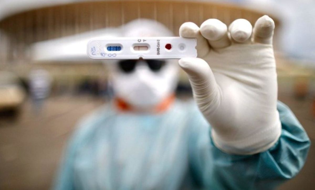 Anvisa aprova testes rápidos para covid-19 em farmácias