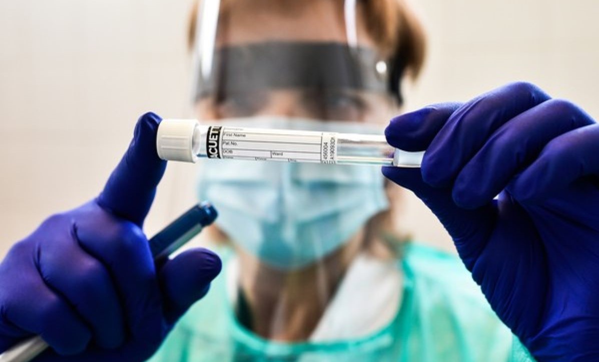 Mato Grosso registra 40 mortes e 1,4 mil casos de coronavírus