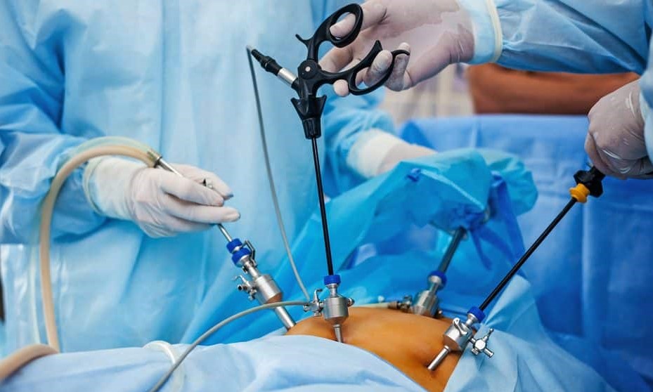 Obrigatoriedade de cirurgias plásticas pelo SUS a pacientes que fizeram bariátrica é discutida na ALMT