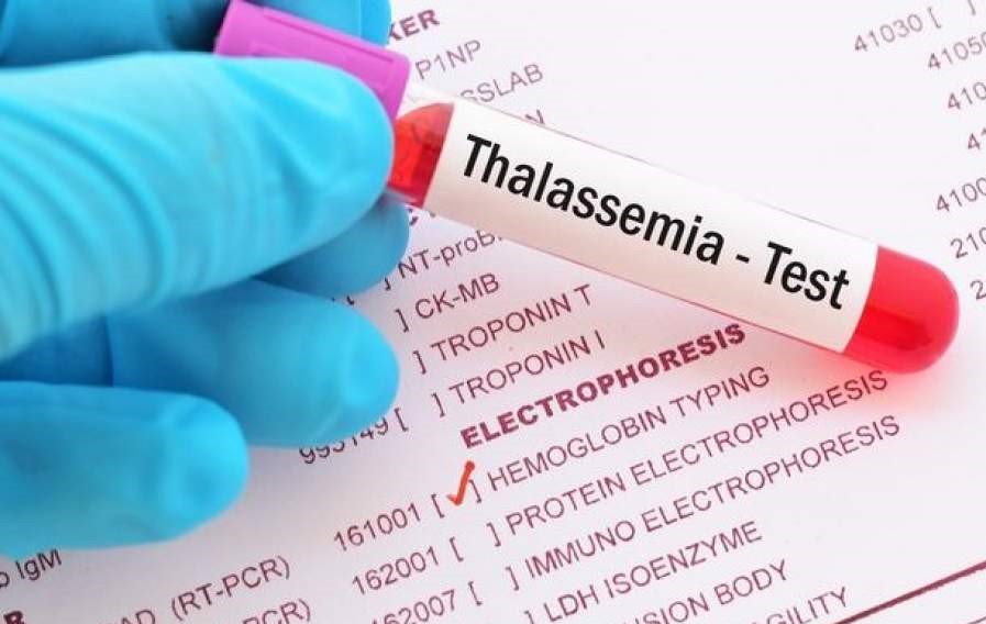 Mato Grosso |  Hemocentro registra 42 pacientes com talassemia