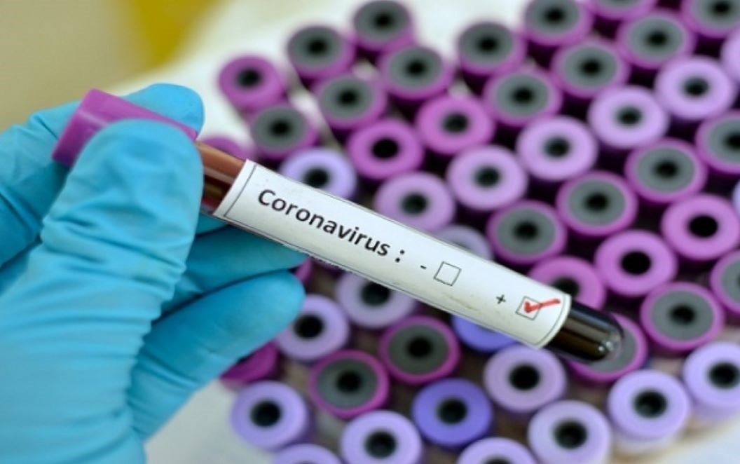 Onze pessoas morrem de Covid-19 em MT em uma semana; número de casos da doença quase dobrou