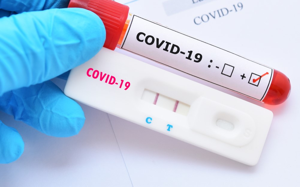 Resultado positivo de teste rápido não comprova imunidade à covid-19