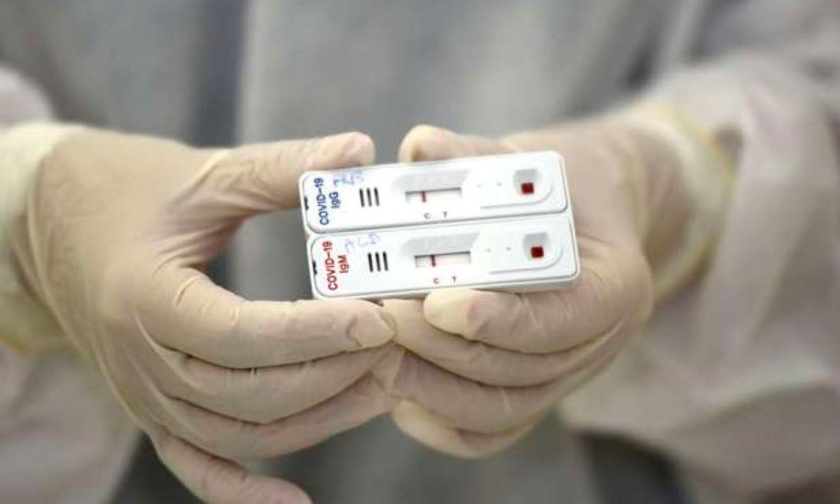Novo teste de saliva para identificar covid-19 custará R$ 95