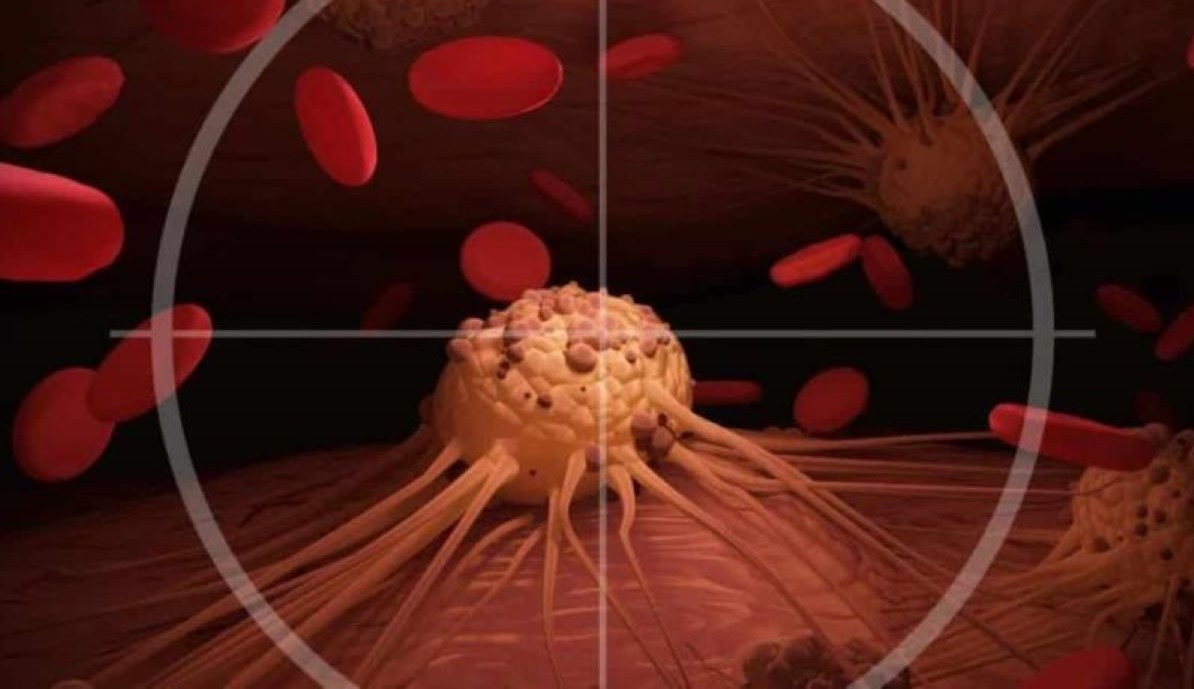 Novo medicamento interrompe crescimento de câncer em humanos