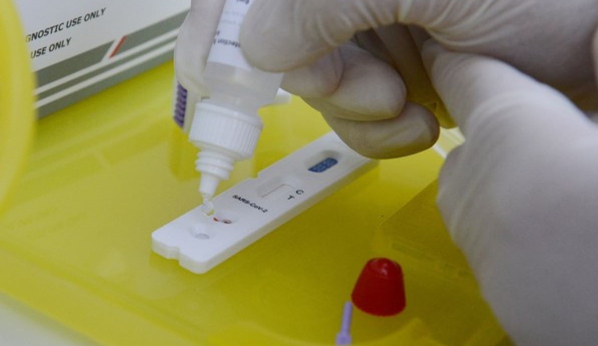 Mato Grosso registra 6.108 casos e 213 óbitos por Covid-19