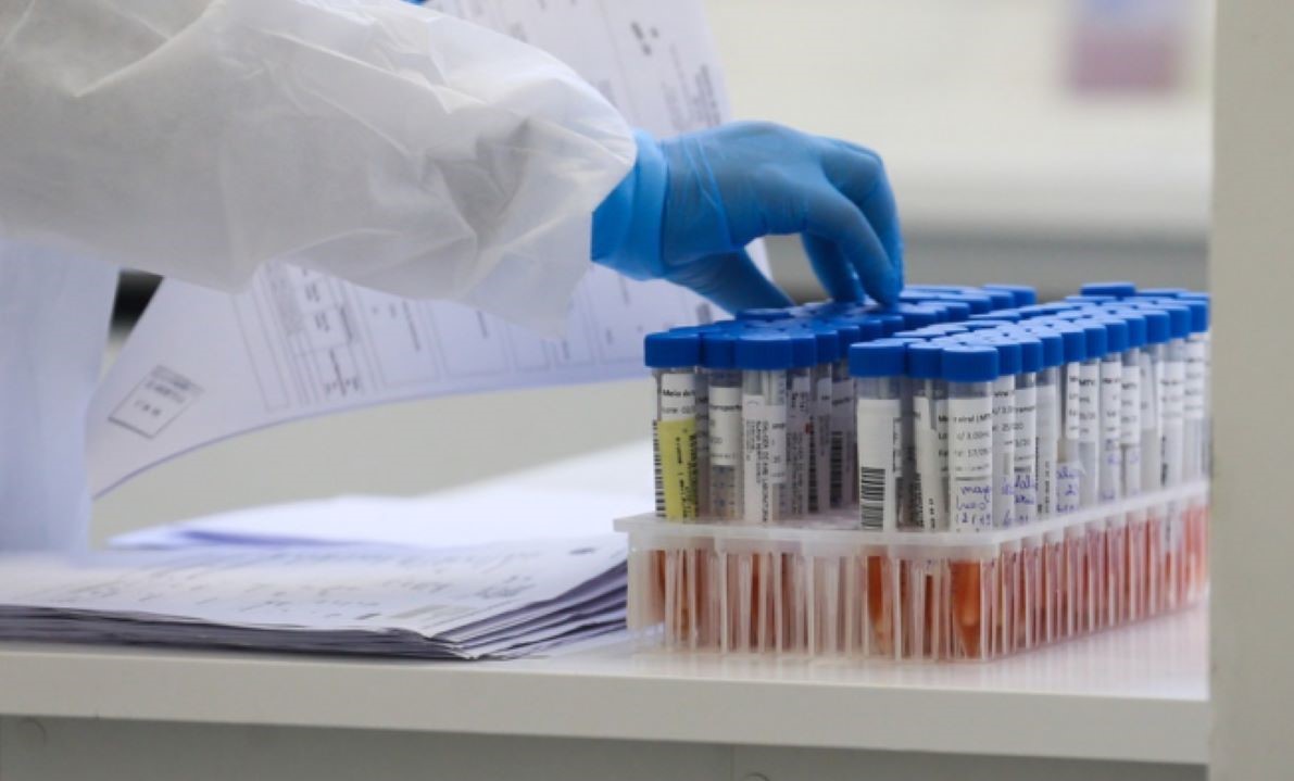 Mato Grosso | Dos quase 7 mil infectados, mais de 2 mil já venceram a covid-19