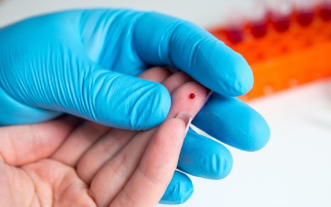 Saúde acredita que levantamento do Ibope sobre Covid-19 dará desenho da epidemia em Rondonópolis