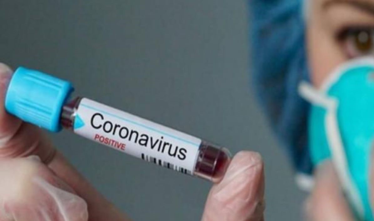 Mato Grosso já registrou mais de 10 mil casos da Covid-19