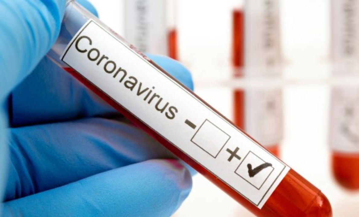 Rondonópolis registra mais quatro mortes por Covid-19