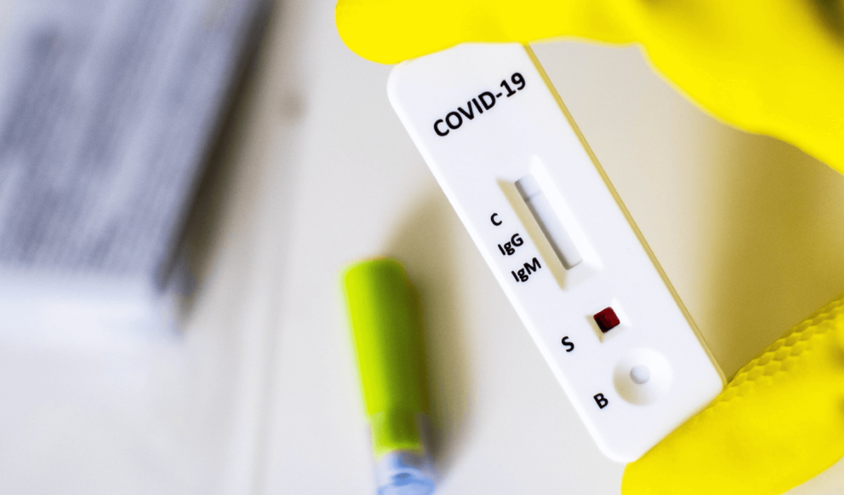 ANS torna obrigatória cobertura de teste Covid-19 por planos de saúde