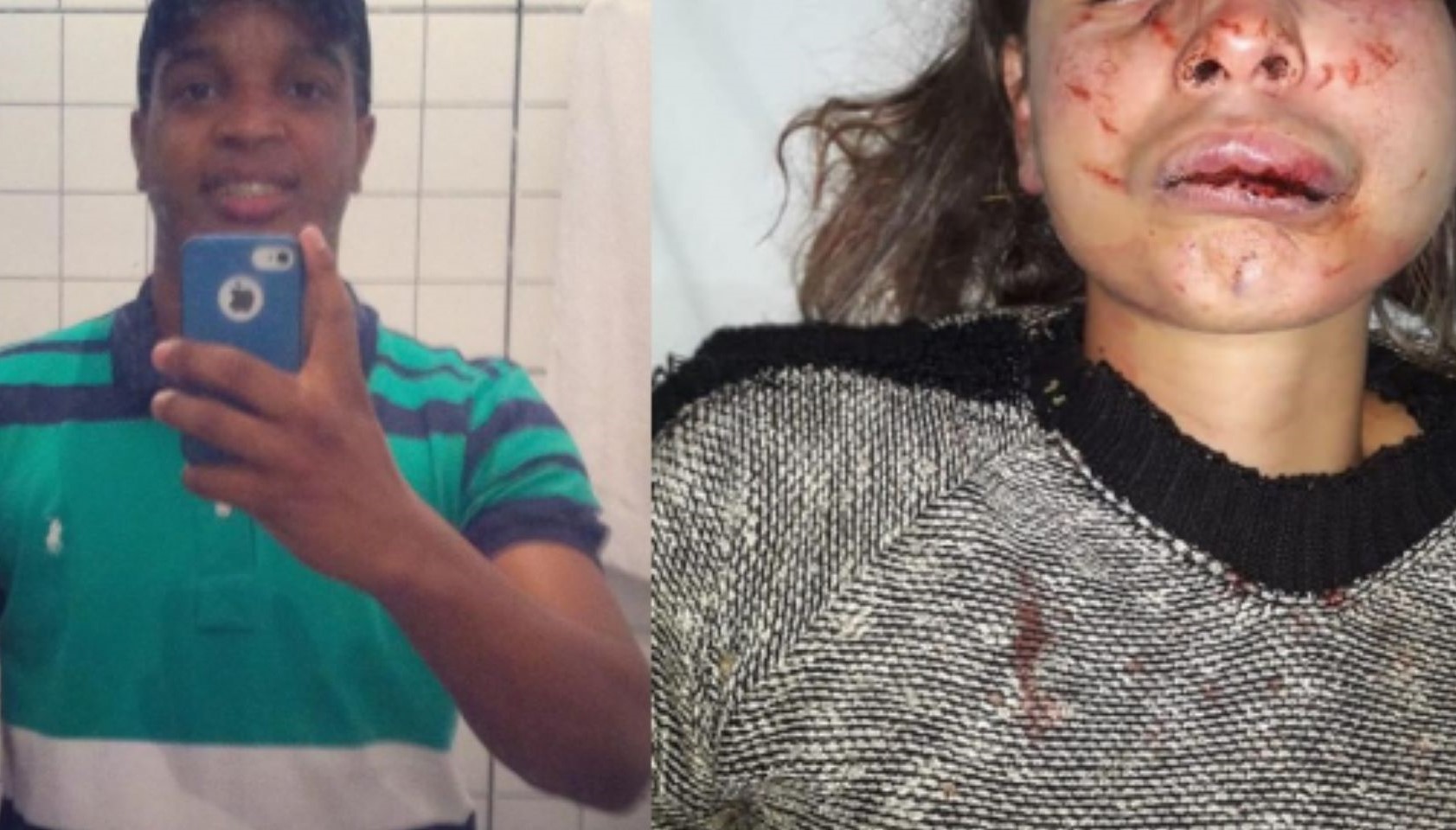 Mato Grosso | Mulher tem rosto desfigurado após ser agredida e pisoteada pelo marido bêbado