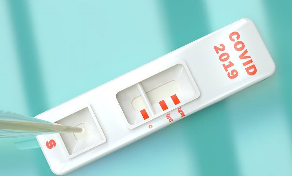 Mato Grosso | Governo envia 300 mil testes rápidos para os municípios a partir desta quinta-feira