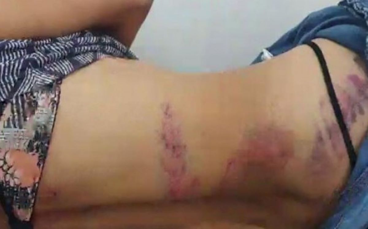 Tangará da Serra | Mulher é sequestrada pelo ex e espancada durante três dias