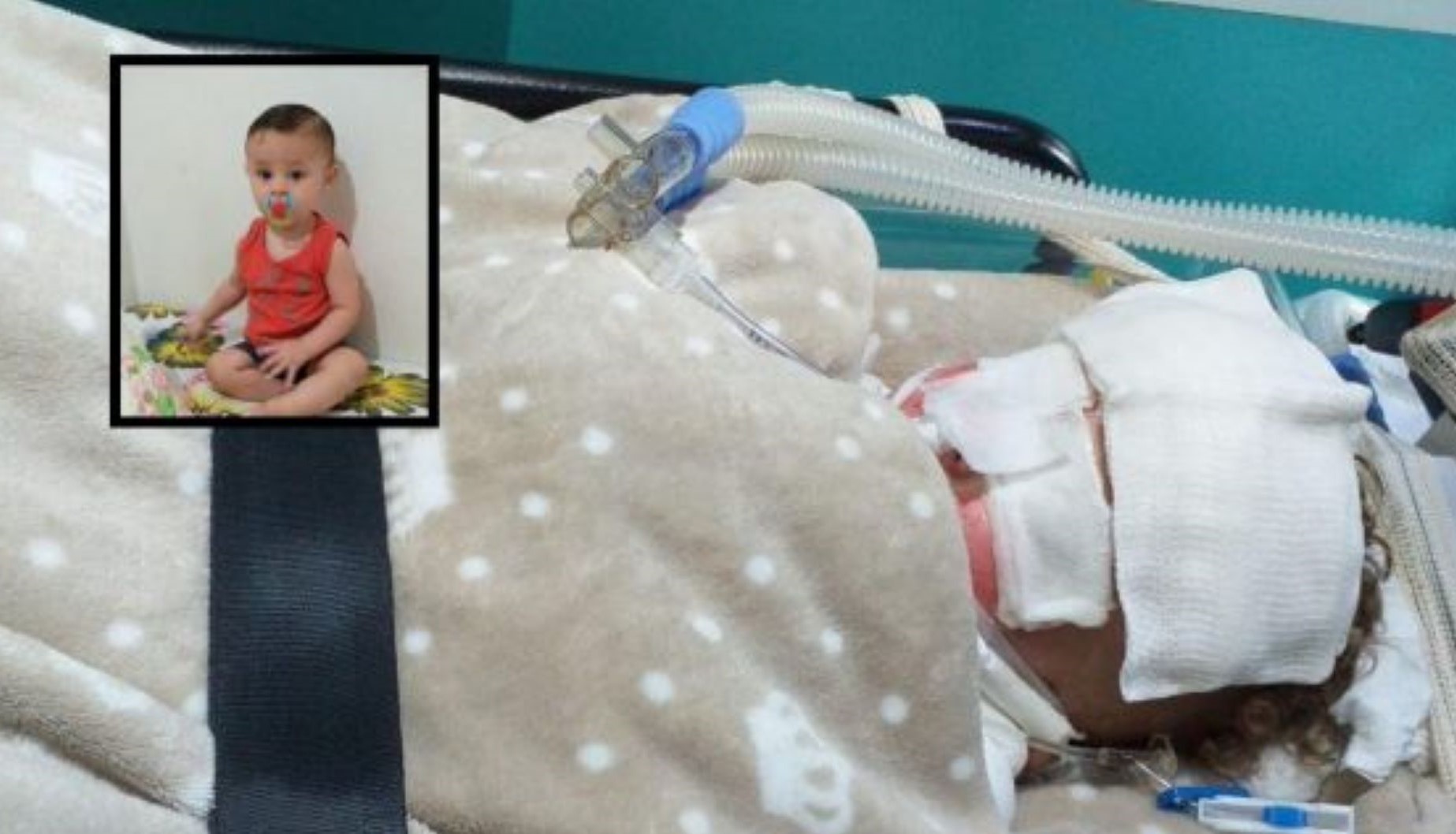 Explosão em sítio deixa bebê com 80% do corpo queimado; criança está na UTI em Cuiabá