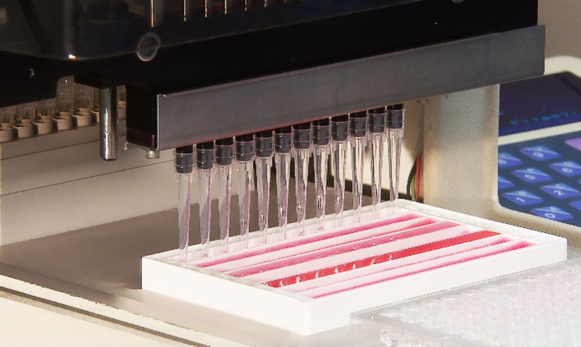 Fiocruz e AstraZeneca alinham detalhes para produção de vacina
