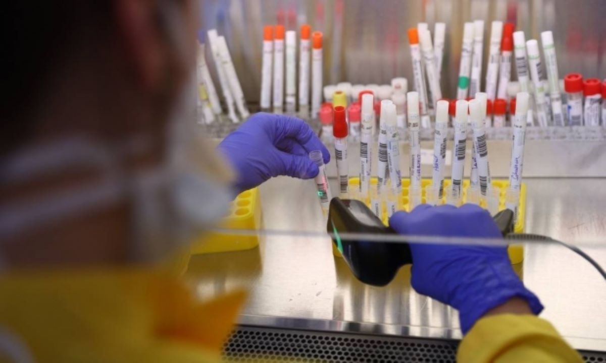 Mato Grosso registra 58.475 casos e 2.013 óbitos por Covid-19