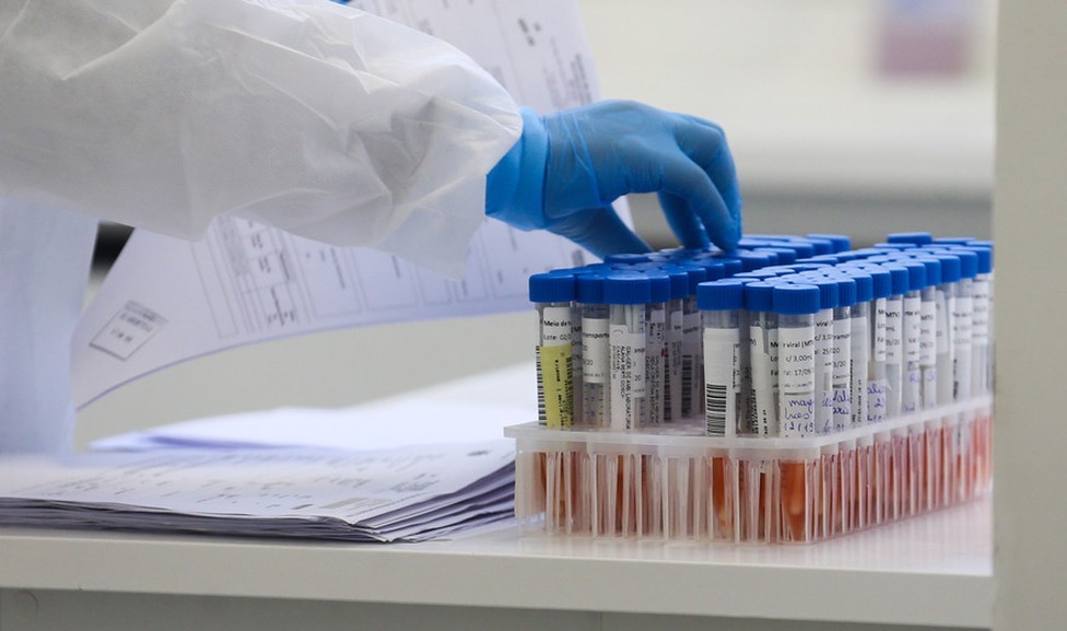 Quatro municípios de MT estão com risco muito alto de contaminação de Covid-19