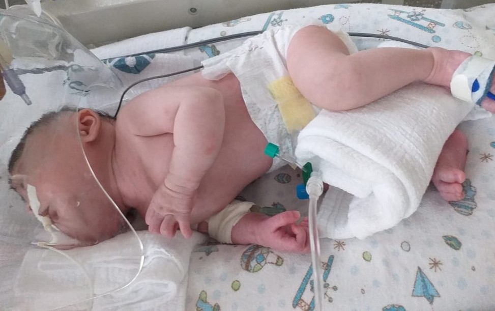 Mato Grosso | Bebê que aguardava cirurgia por ter nascido com malformação morre com Covid-19