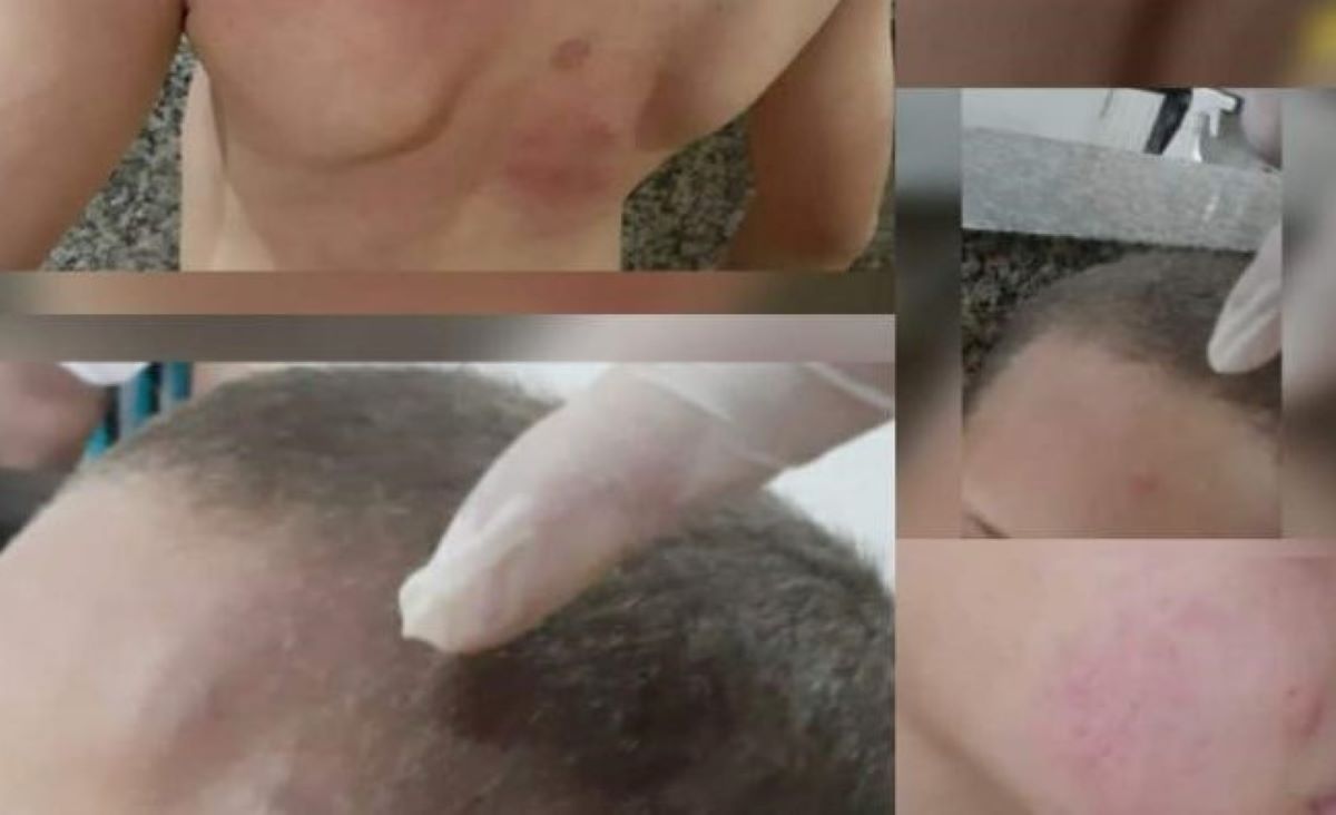 Bêbado espanca filho de 6 anos; menino ameaçou se matar