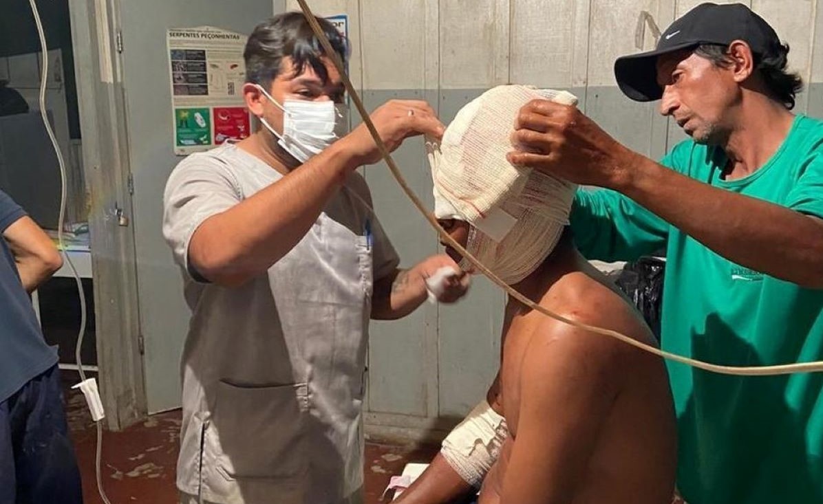 Mato Grosso | Índio é atacado por onça-pintada e passa por cirurgia na cabeça